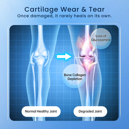 VitaRealm Joint Support  | Upgraded Glucosamine MSM Chondroitin Hyaluronic Acid